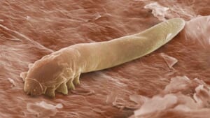 Demodex - Loài bọ ký sinh trên cơ thể người
