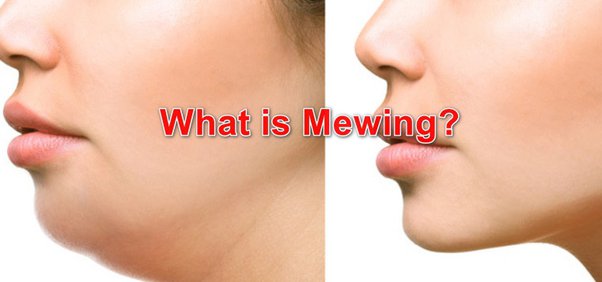 mewing là gì