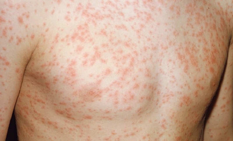 tác dụng phụ của đông trùng hạ thảo